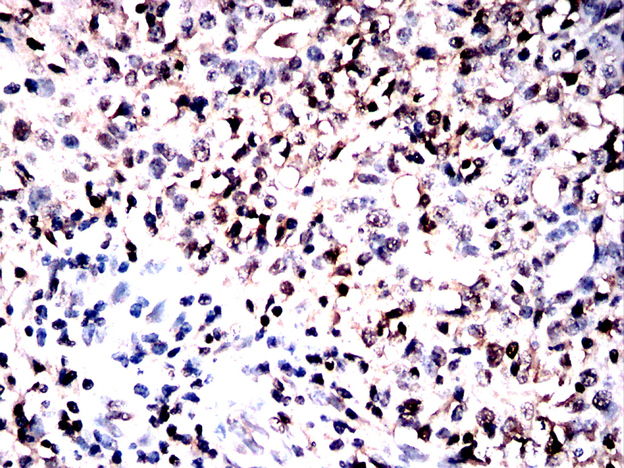                          IHC